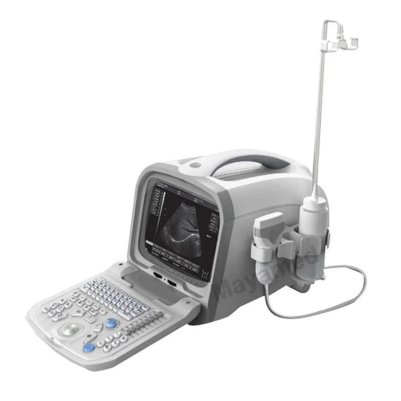 Factory supplying MY-A002 Medical Portable 10 Inch B/W All-Digital Ultrasound Scanner Diagnosing Equipment