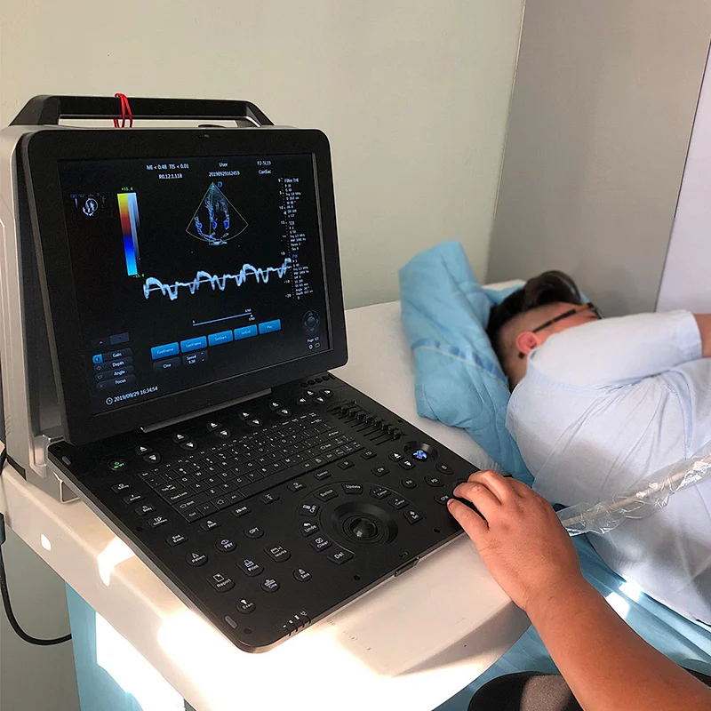 New products 15 inch LCD display cardiac color doppler portable ultrasound machine with probe