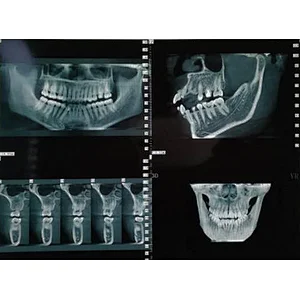 MY-D068 Medical dental x ray machine price , digital panoramic dental x-ray machine with CEPH