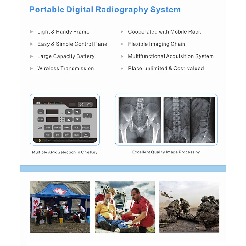 Digital plate radiograph xray machine system industrial film mobile dr portable X-rays lead numbers medical portable radiographi