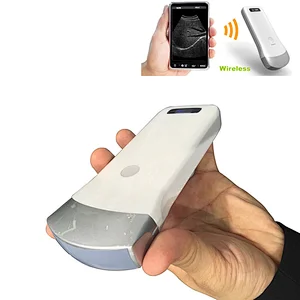 China supply hot sale better than brand medical equipment portable wireless wifi ultrasound
