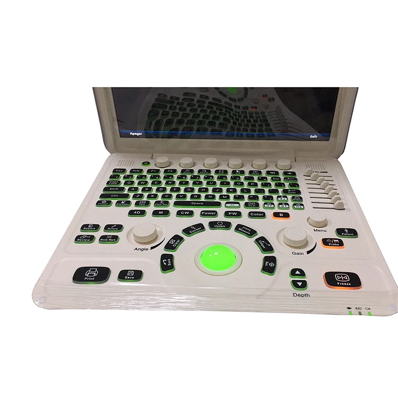 Fully digital medical ultrasound scanner portable , color doppler ultrasound machine