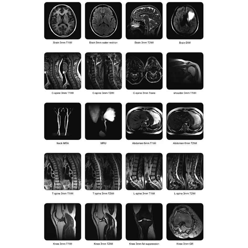 MY-D054A dual pillar magnet design hospital 0.5T medical mri equipments