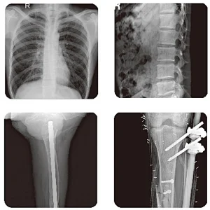 Guangzhou Medical x-ray equipment system direct radiography mobile x-ray machine digital x ray machine