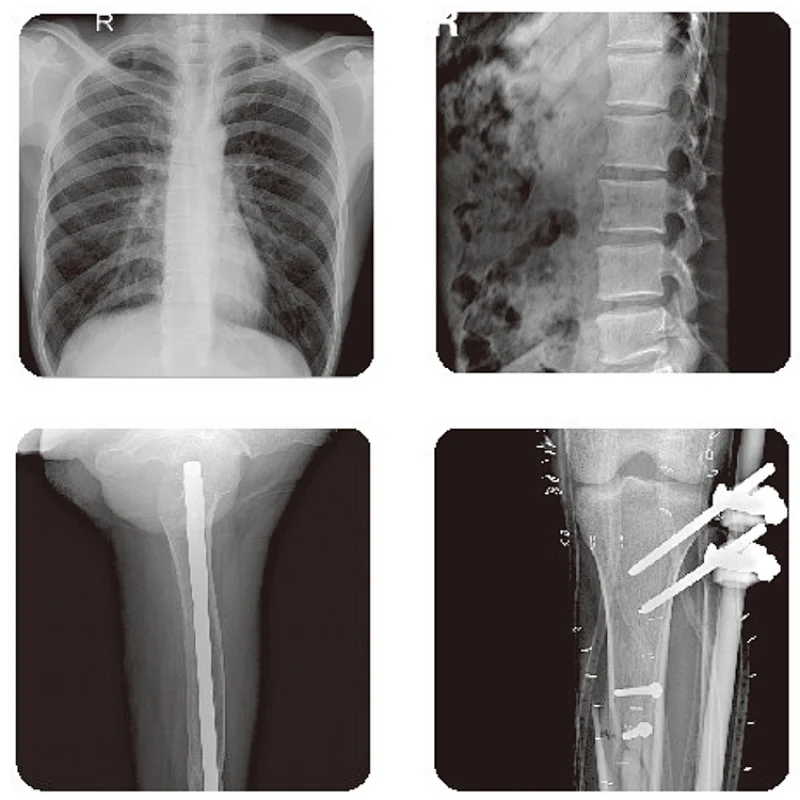 Guangzhou Medical x-ray equipment system direct radiography mobile x-ray machine digital x ray machine