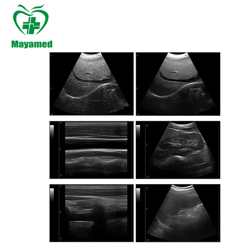 Top Selling Transductor Ecografia 12.1-inch LED All digital Ultrasound System Portable Ultrasound machine with Convex probe