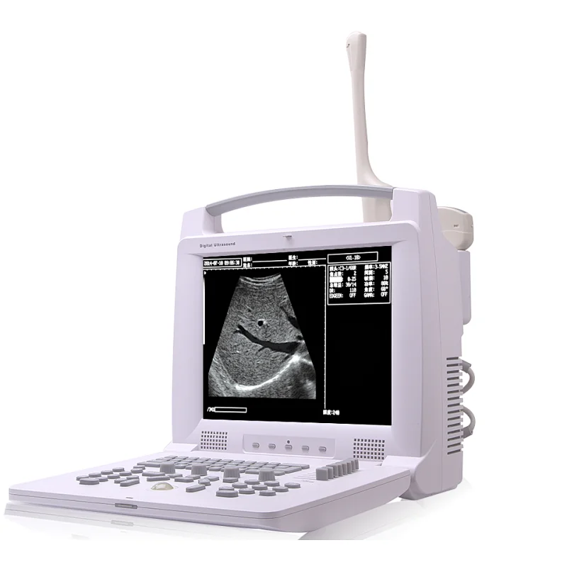 B scan ophthalmic ultrasound mindray low price buy ultrasound machine pricescreen therapy gel pocket probes physical therapy