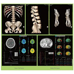 Hot sale price medical equipment High Resolution monitor dual 16 slice ct scan machine