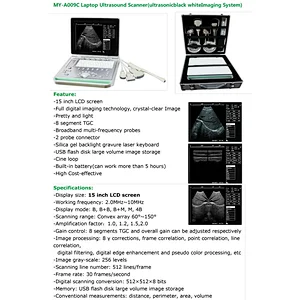 High quality echocardiography diagnostic machine Portable Laptop Ultrasound Scanner with Probe