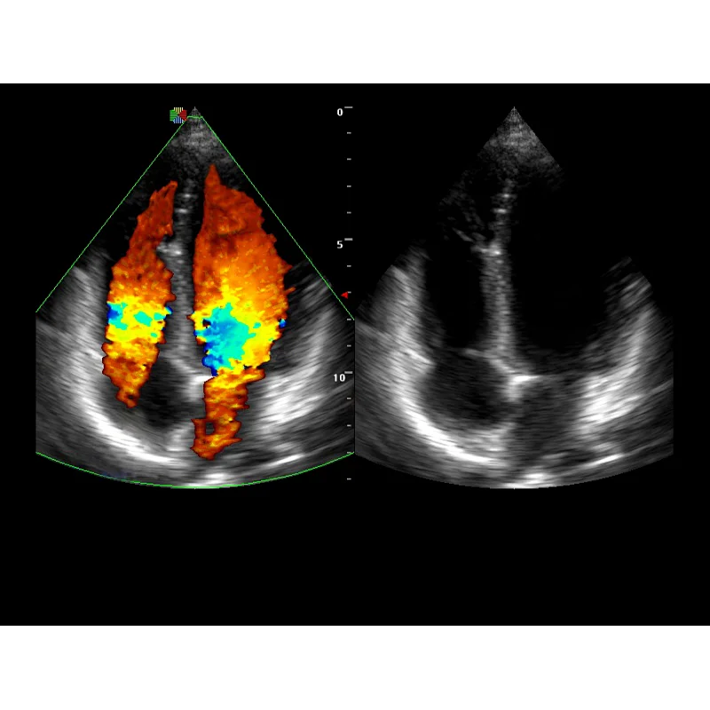 MY-A029 Maya medical product Color Doppler ultrasound scanner with CE approved