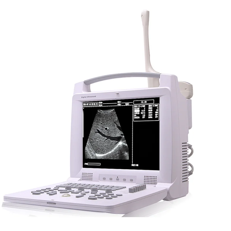 MY-A005 12 inch screen cheapest portable ultrasound scanner,digital ultrasound machine price