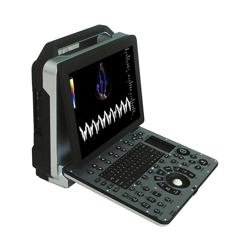 New products 15 inch LCD display cardiac color doppler portable ultrasound machine with probe