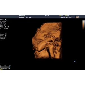 MY-A029 Maya medical product Color Doppler ultrasound scanner with CE approved