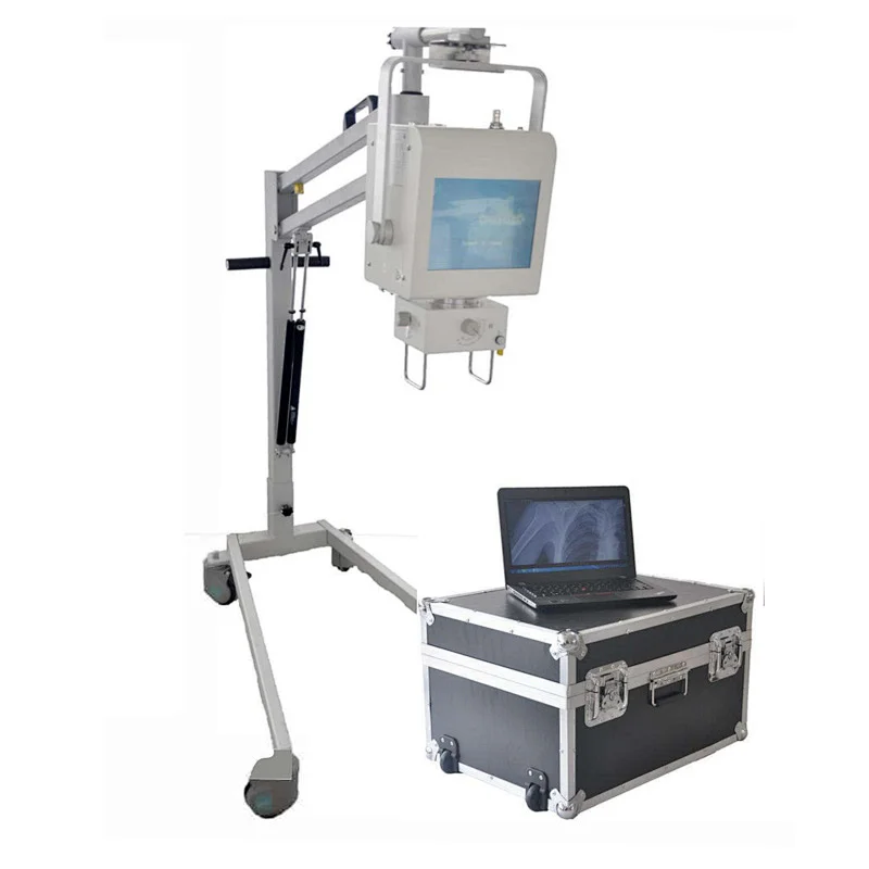 Portable X ray Machine Price Digital Scanner Medical X-ray Sensor Printer Equipments Detector Mobile Panoramic Cr X-rays System