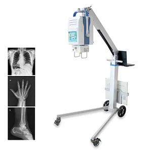 MY-D049R digital portable mobile radiography x- ray system medical x ray machine