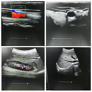 MY-A034B Standard 3.5Mhz convex probe mobile ultrasound machine color doppler