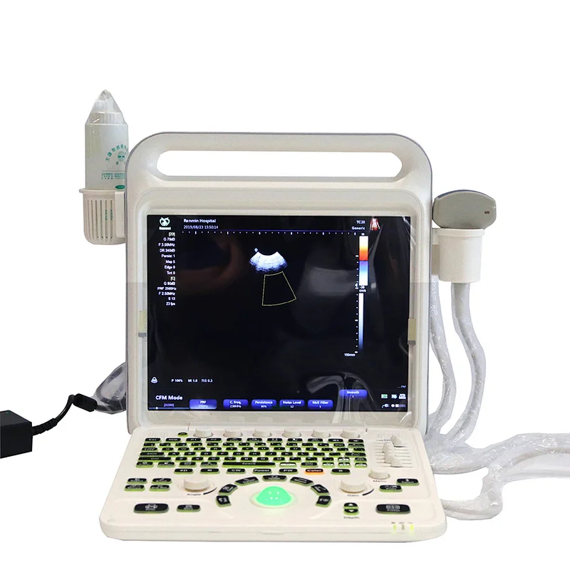 Hot Sale New MY-A027B Portable Medical Full Digital Color Doppler Ultrasound Scanner /Ultrasound Machine Price