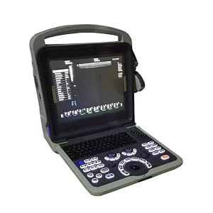 Multiparametro veterinarios medical sonoscape portable Full Digital monitor Color Doppler Ultrasound machine/scanner with  Probe