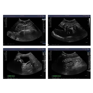 China supplier 15 inch LCD flat screen 4D full digital portable ultrasound scanner machine