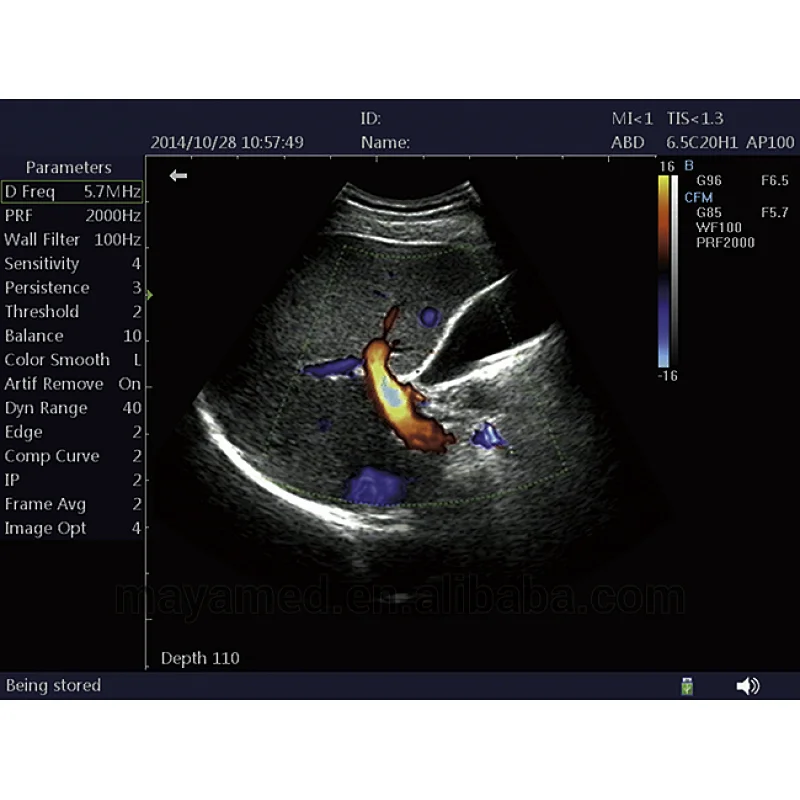2020 sonoscape new design Trolley type multi-frequency color doppler portable mindray ultrasound scanner from China