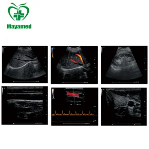 High resolution MAYA medical MY-A033 portable 15 inch 2D Digital Color Doppler Ultrasound System B Ultrasound machine