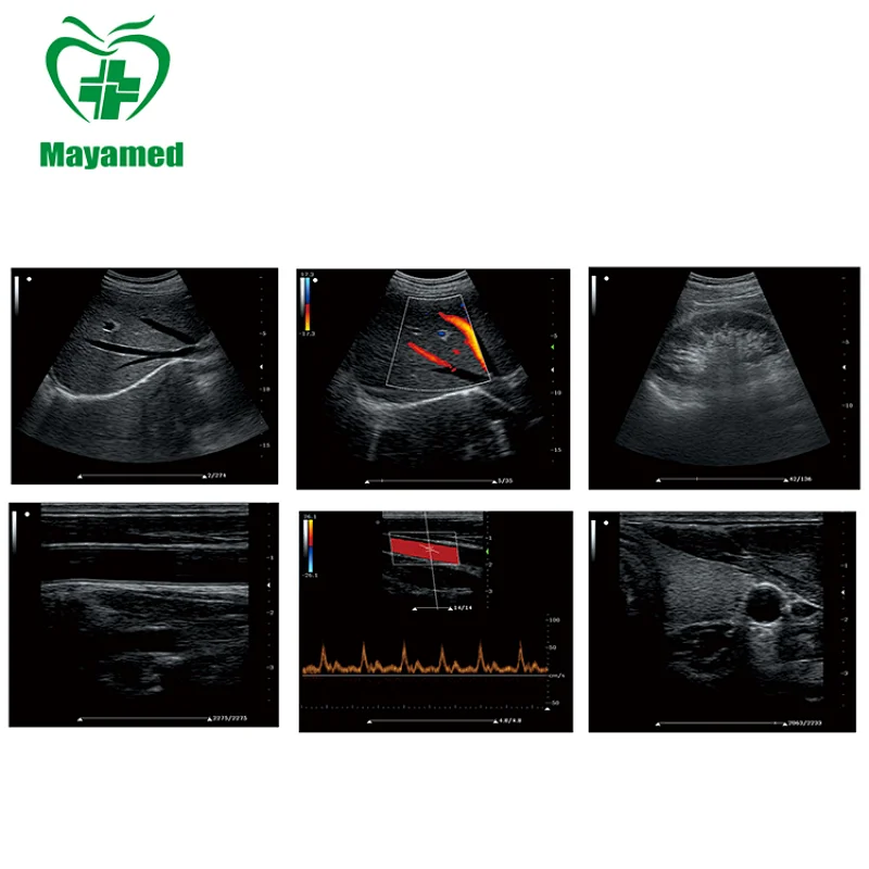 High resolution MAYA medical MY-A033 portable 15 inch 2D Digital Color Doppler Ultrasound System B Ultrasound machine