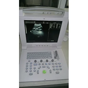 Portable mindray ultrasound obstetric MY-A002A hospital All-Digital Ultrasound Diagnosing Equipment