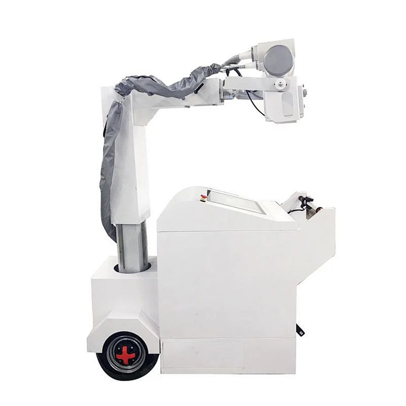 MY-D049V Digital x-ray radiography system mobile medical xray machines for sale