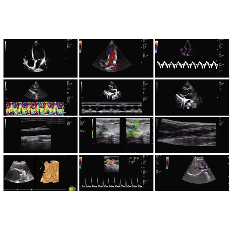 Trolley color doppler medical ultrasound instruments china ultrasound machine price