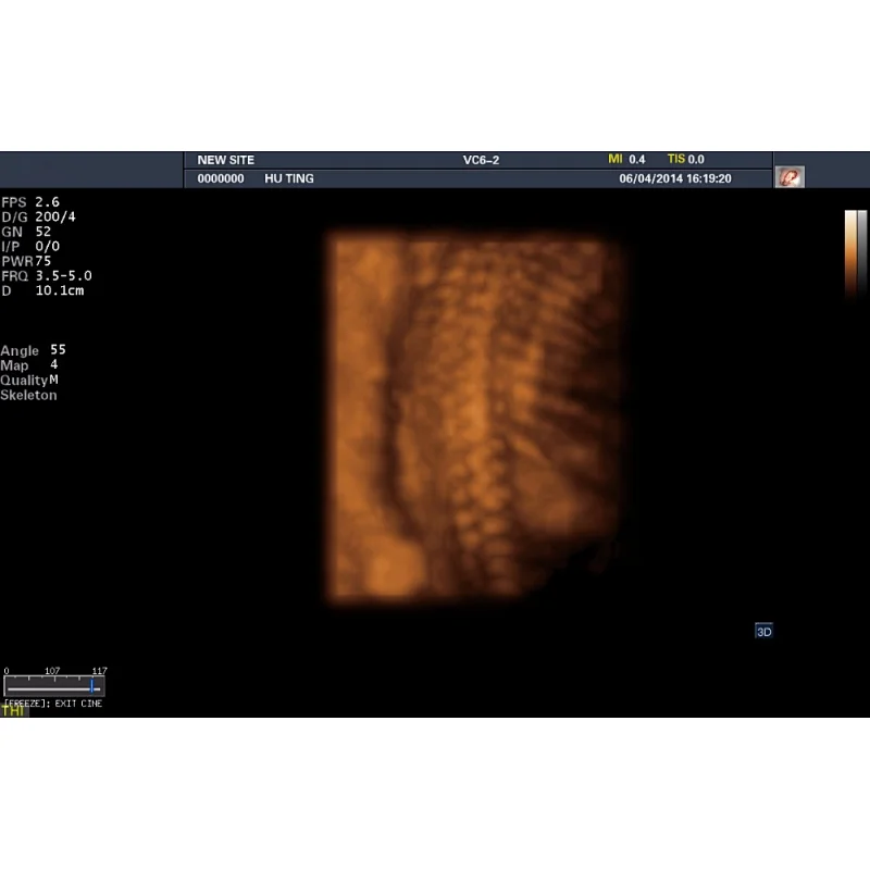 MY-A029 Maya medical product Color Doppler ultrasound scanner with CE approved