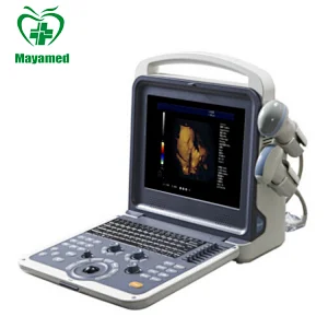 Multiparametro veterinarios medical sonoscape portable Full Digital monitor Color Doppler Ultrasound machine/scanner with  Probe