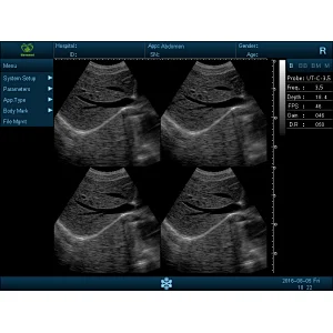 Doppler sonoscape ultrasound trolly machine price cheapest screen echography wireless led beauty medical equipment suppliers