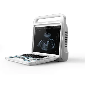 Portable dppler ultrasound trolly machine diagnosing cheapest ltrasound machine echography wireless ultrasound medical equipment