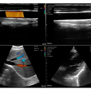 MY-A023H electronic array color doppler portable ultrasound scanner wifi wireless ultrasound probe