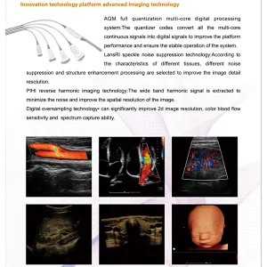 MY-A034C Digital Color Doppler Diagnostic Scanner rich clinical application functions