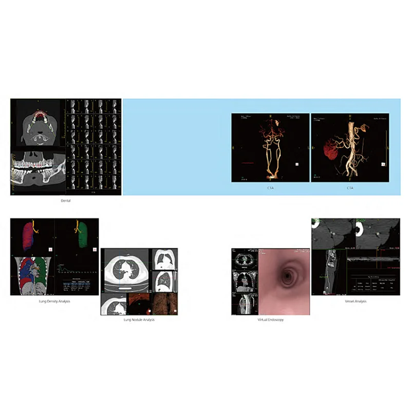 Hot sale price medical equipment High Resolution monitor dual 16 slice ct scan machine