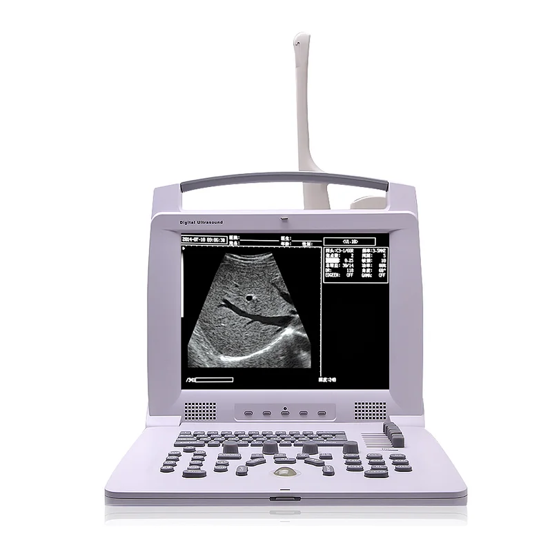 Portable screen ultrasound instruments machine scanner digital mindray ultrasouns price doppler obstetrics ultrasound machines