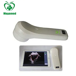 Medical 4D Wireless Hospital Bladder Scanner