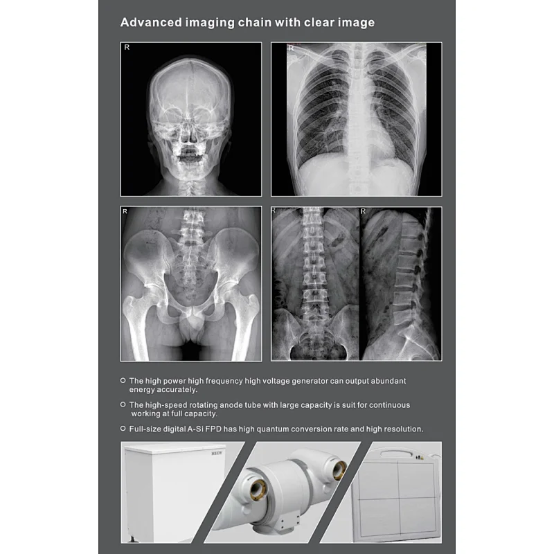 MY-D049J-A medical device radiography x- ray system digital x-ray equipment