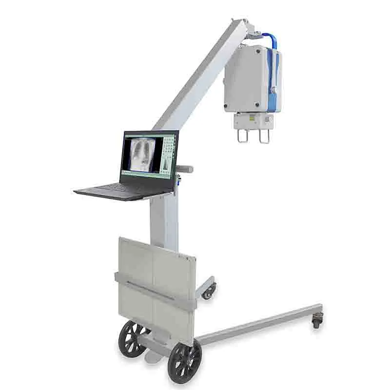 MY-D049R digital portable mobile radiography x- ray system medical x ray machine
