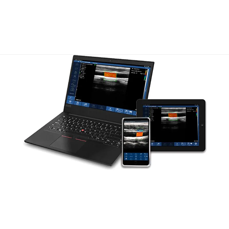 MY-A023H electronic array color doppler portable ultrasound scanner wifi wireless ultrasound probe