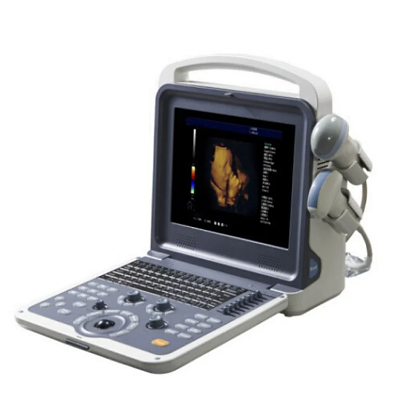 MY-A035B medical portable type Full Digital Color Doppler Ultrasound Diagnostic System with probe
