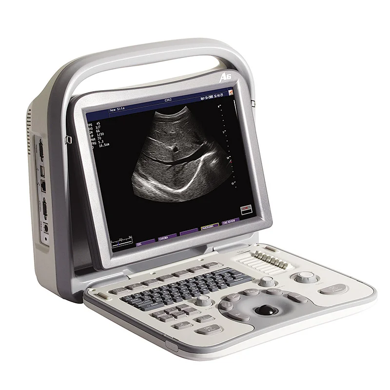 128 elements portable ultrasound scanner,medical ultrasound instruments