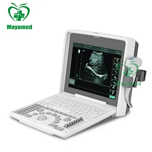 MY-A003(new) portable ultrasound scanner machine price with Multi-frequency Convex probes