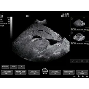 Veterinary touch screen portable ultrasound scanner,black & white ultrasound machine price
