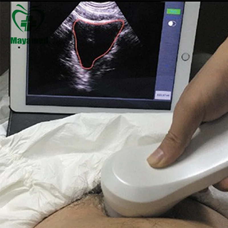 MY-A010F 4D wireless probe bladder scanner prices in Portable Ultrasonic Diagnostic Devices