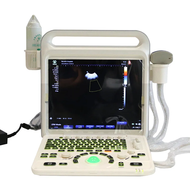 MY-A027B 15 inch screen medical ultrasound instruments,portable ultrasound machine color doppler
