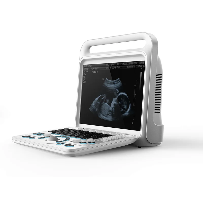 Price ecografo veterinarios eco usb multiparametro veterinarios medical equipment sonoscape dopler portable cheap ultrasound