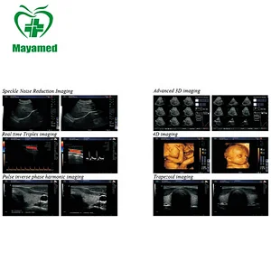 High quality MY-A031B hospital professional Digital Color Doppler Ultrasound Scanner System(3D/4D)