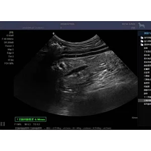 6 in 1 Cavitation ultrasound trolly machine price cheapest inch fat ultrasound machine echography wireless led beauty ultrasound